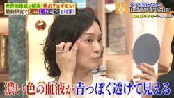 世界的権威が解説！ 3タイプの『クマ』の見分け方とは？ 目立たなくする方法も…｜#林修の今知りたいでしょ！ #TVer で最新話配信中！